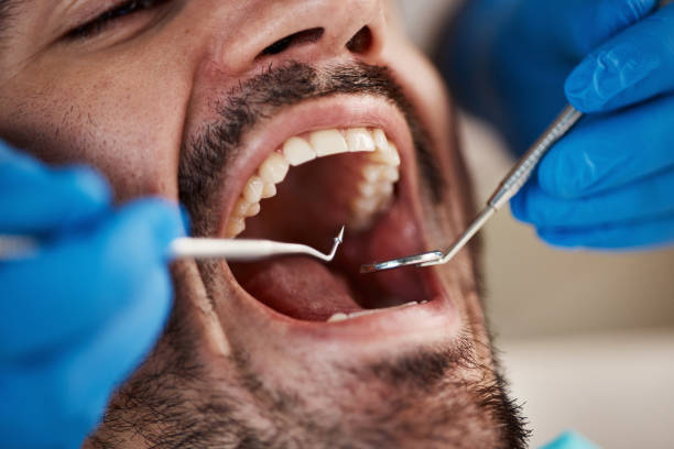 Best Tooth Extraction  in Otterbe, IN